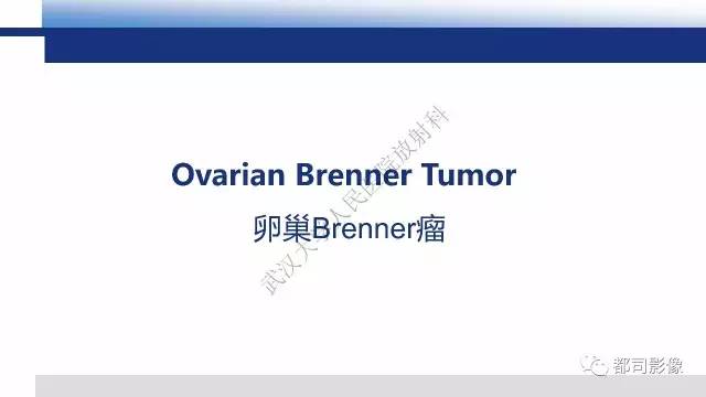 【PPT】卵巢Brenner瘤影像诊断