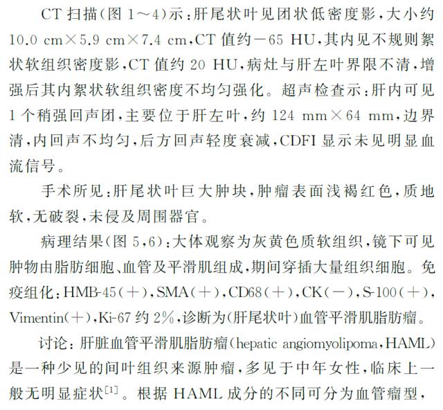 【病例】肝脏血管平滑肌脂肪瘤１例CT
