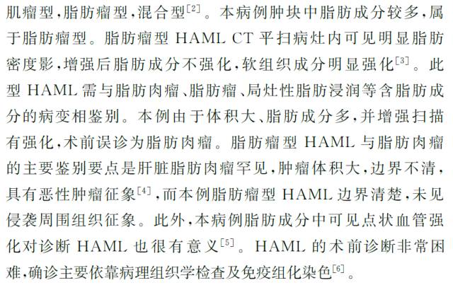 【病例】肝脏血管平滑肌脂肪瘤１例CT