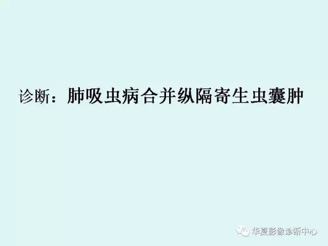 【病例】肺吸虫病1例CT影像表现