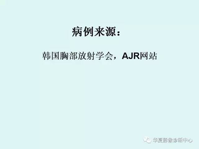 【病例】肺吸虫病1例CT影像表现