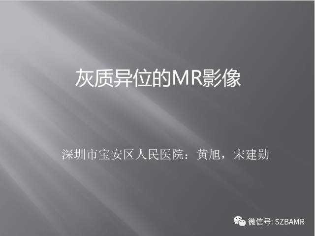 【PPT】灰质异位的MR影像