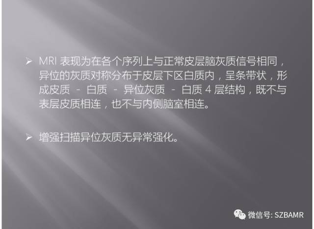 【PPT】灰质异位的MR影像