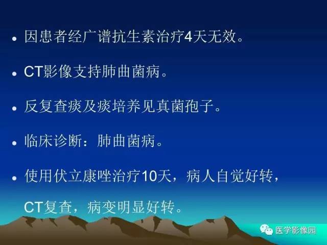 【病例】肺曲霉菌病1例CT