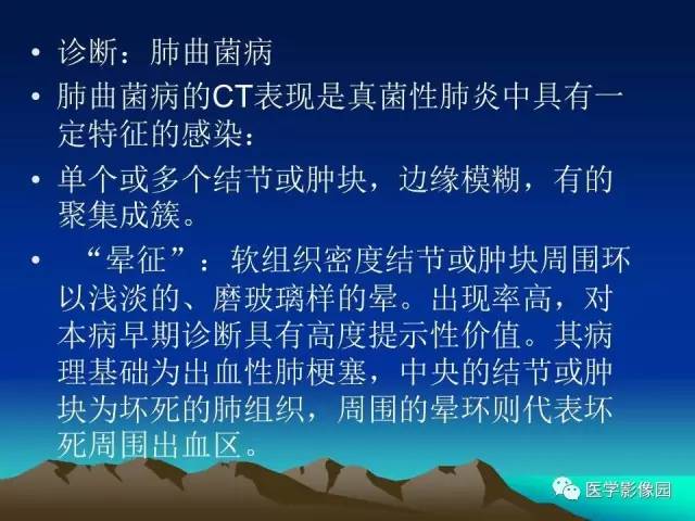 【病例】肺曲霉菌病1例CT