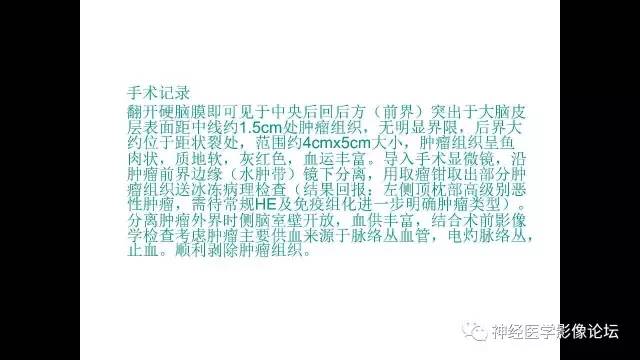 【病例】左侧顶枕叶转移性小细胞癌一例MR影像讨论