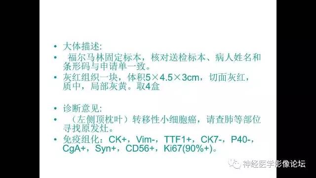 【病例】左侧顶枕叶转移性小细胞癌一例MR影像讨论
