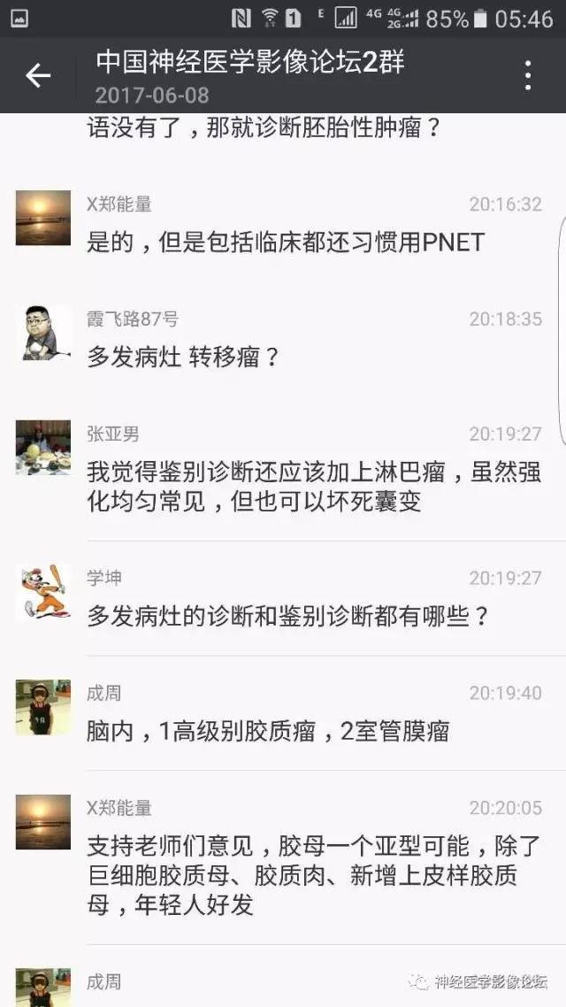 【病例】左侧顶枕叶转移性小细胞癌一例MR影像讨论