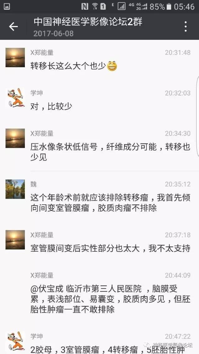 【病例】左侧顶枕叶转移性小细胞癌一例MR影像讨论