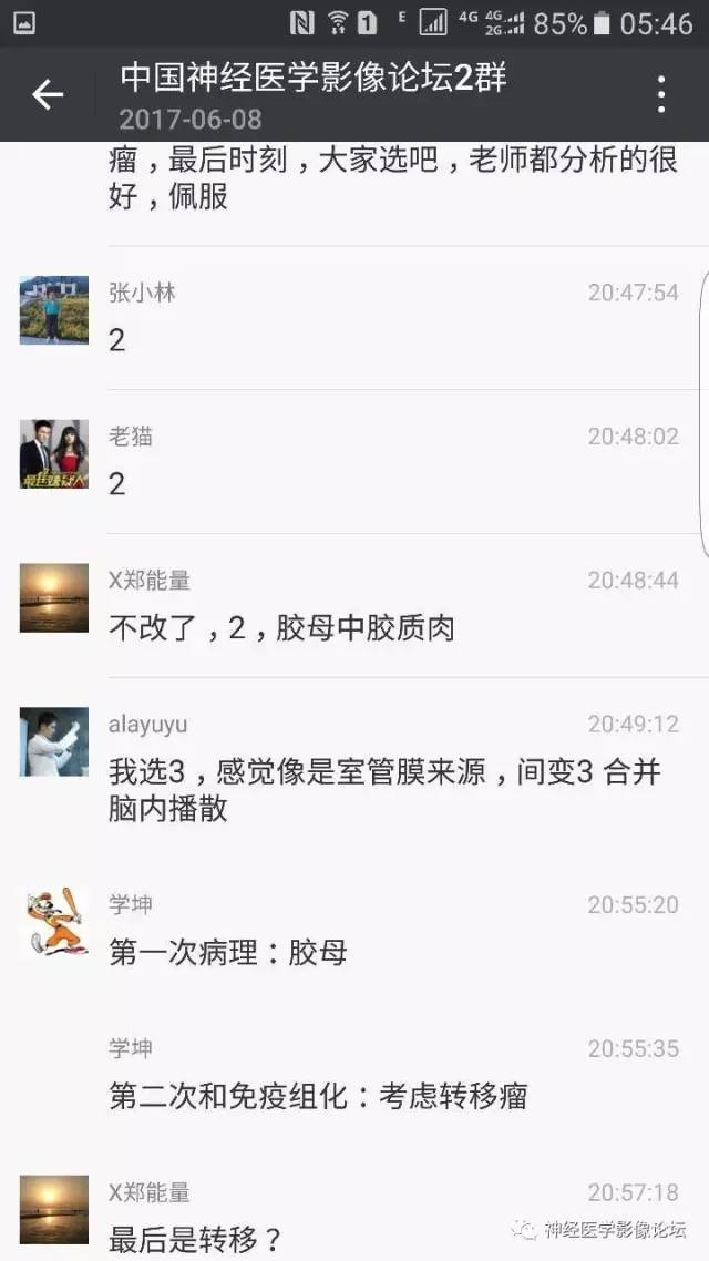 【病例】左侧顶枕叶转移性小细胞癌一例MR影像讨论