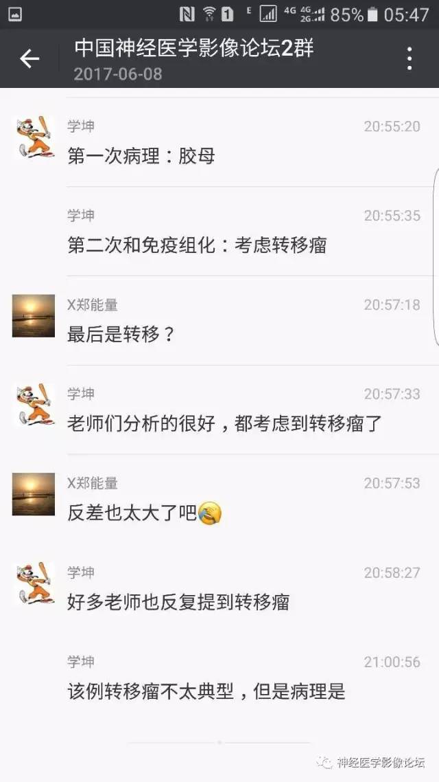 【病例】左侧顶枕叶转移性小细胞癌一例MR影像讨论