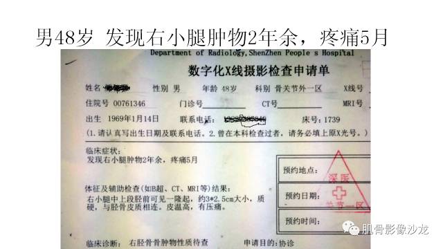 【病例】骨样骨瘤两例X线CT及MR