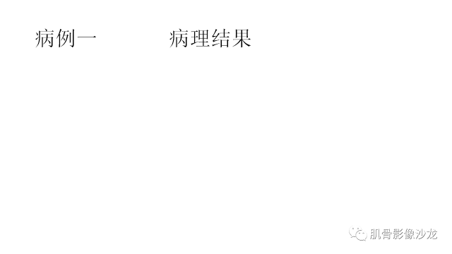 【病例】骨样骨瘤两例X线CT及MR