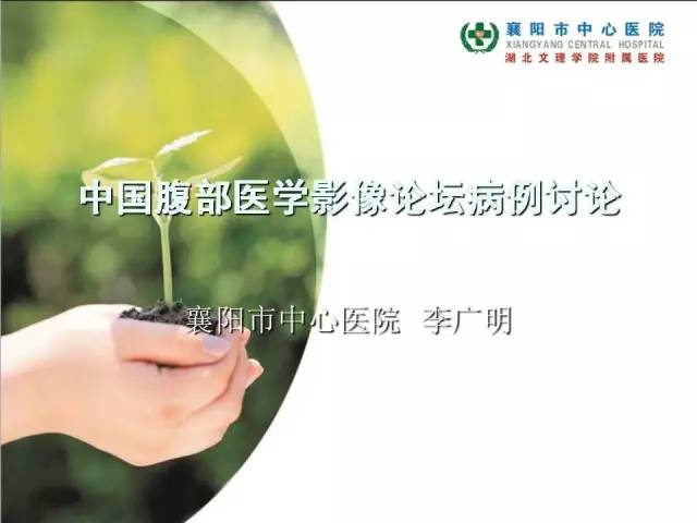 【病例】左肾上极、肾门及髂腰肌多发副神经节瘤1例MR