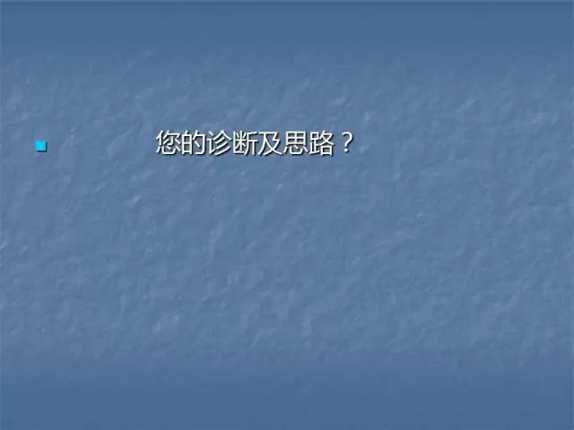【病例】左肾上极、肾门及髂腰肌多发副神经节瘤1例MR