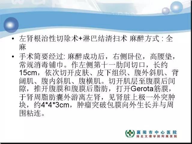 【病例】左肾上极、肾门及髂腰肌多发副神经节瘤1例MR