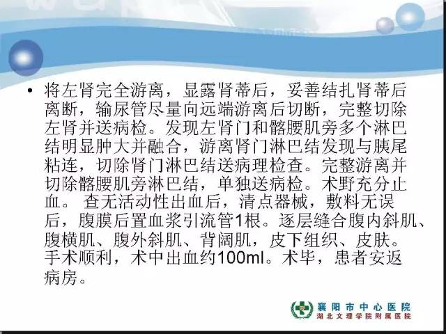 【病例】左肾上极、肾门及髂腰肌多发副神经节瘤1例MR