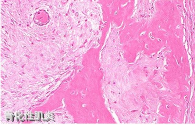 骨关节影像学征象—— 骨关节影像学征象——