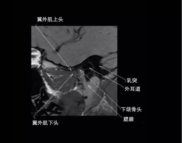 颞下颌关节解剖