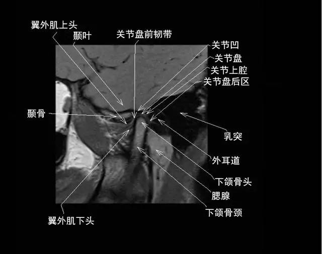 颞下颌关节解剖