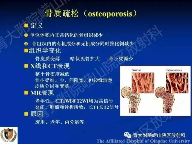 【PPT】骨关节基本病变