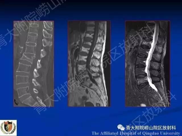 【PPT】骨关节基本病变