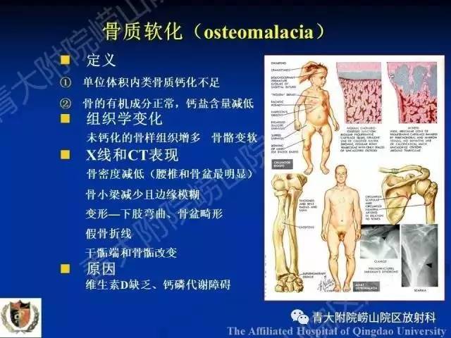 【PPT】骨关节基本病变