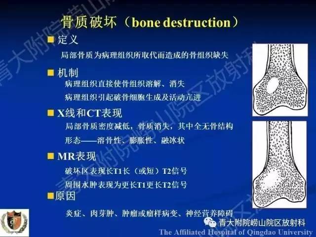 【PPT】骨关节基本病变