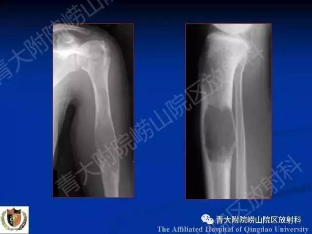 【PPT】骨关节基本病变