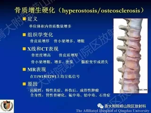 【PPT】骨关节基本病变