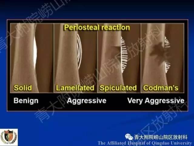 【PPT】骨关节基本病变
