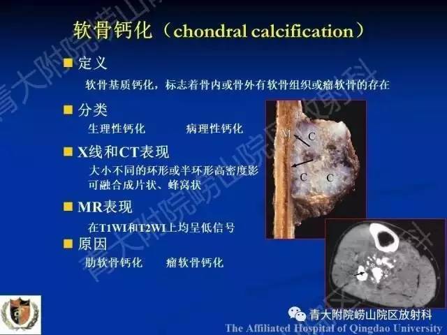 【PPT】骨关节基本病变