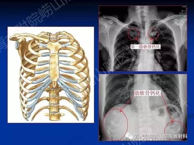 【PPT】骨关节基本病变