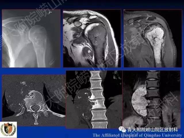 【PPT】骨关节基本病变