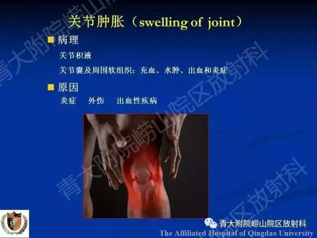 【PPT】骨关节基本病变