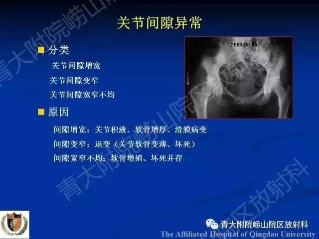 【PPT】骨关节基本病变