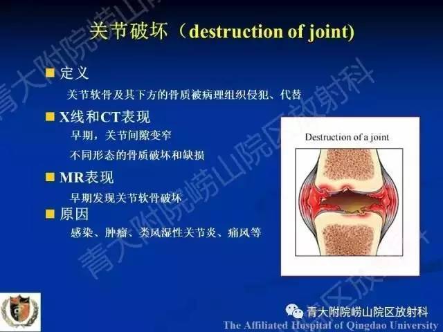 【PPT】骨关节基本病变