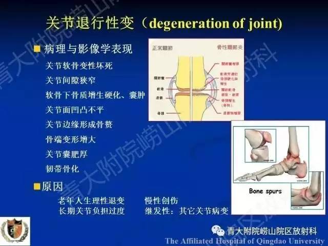 【PPT】骨关节基本病变