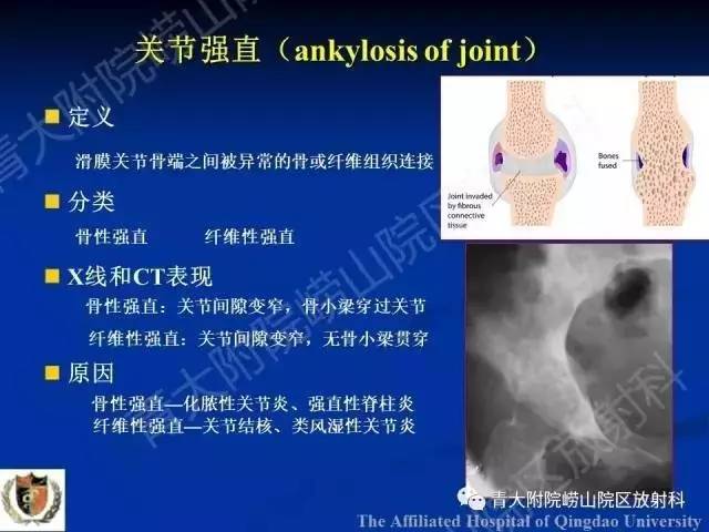 【PPT】骨关节基本病变