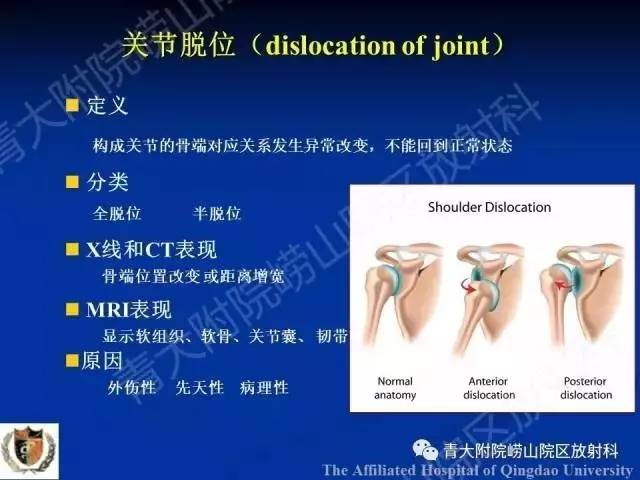 【PPT】骨关节基本病变