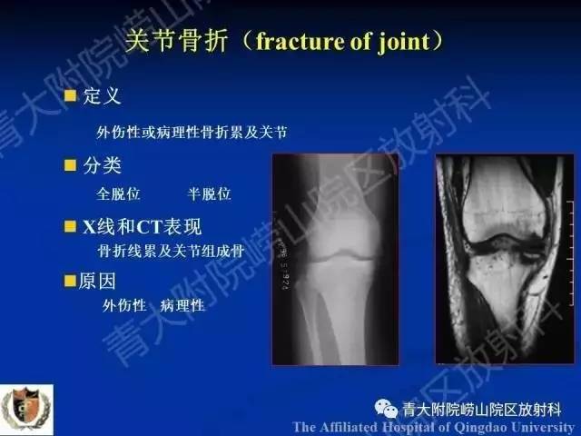 【PPT】骨关节基本病变