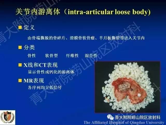 【PPT】骨关节基本病变