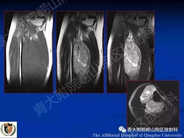 【PPT】骨关节基本病变