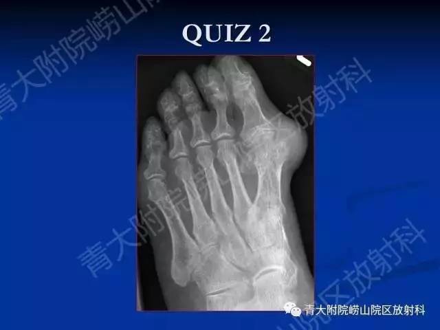 【PPT】骨关节基本病变