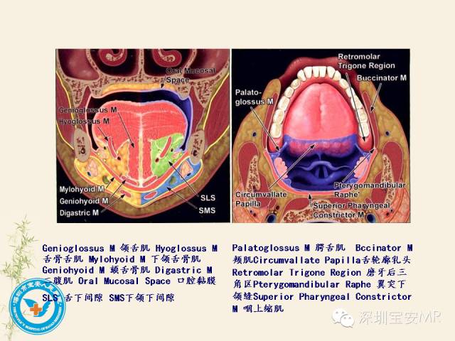 【PPT】舌和口底影像解剖及临床病例一组