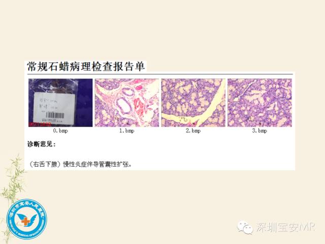 【PPT】舌和口底影像解剖及临床病例一组