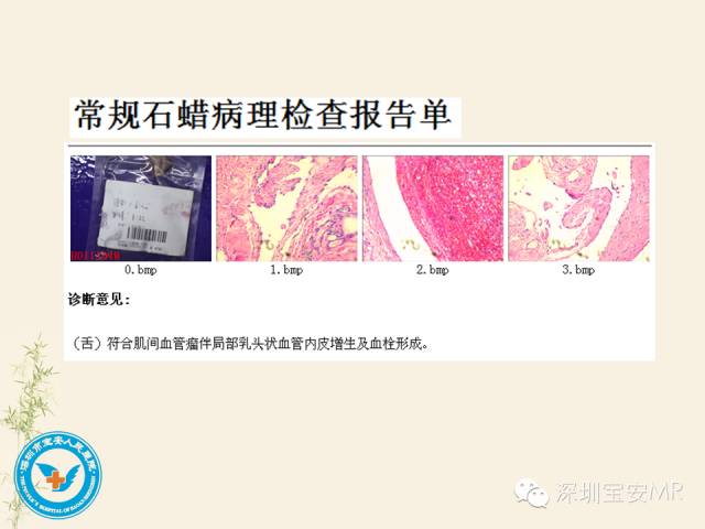【PPT】舌和口底影像解剖及临床病例一组