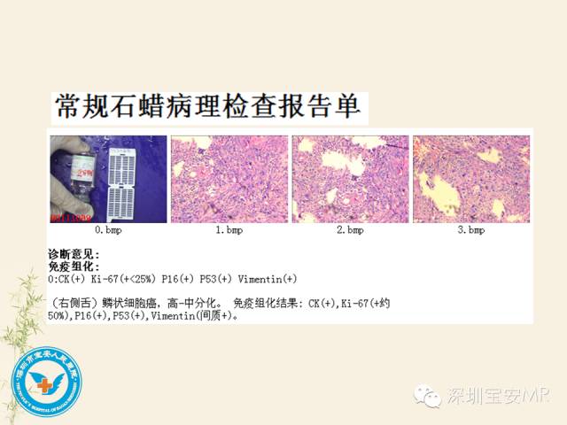 【PPT】舌和口底影像解剖及临床病例一组