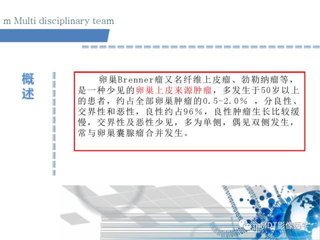 【PPT】卵巢Brenner瘤影像诊断
