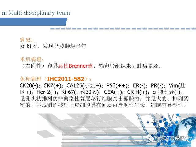 【PPT】卵巢Brenner瘤影像诊断